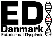 Ectodermal Dysplasia i Danmark